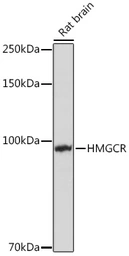 Anti-HMGCR antibody used in Western Blot (WB). GTX54088