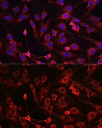 Anti-HMGCR antibody used in Immunocytochemistry/ Immunofluorescence (ICC/IF). GTX54088