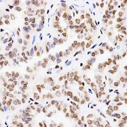 Anti-Histone H3K4me1 (mono-methyl Lys4) antibody used in IHC (Paraffin sections) (IHC-P). GTX54100