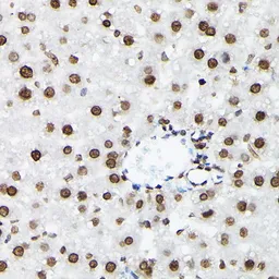 Anti-Histone H3K9me2 (di-methyl Lys9) antibody used in IHC (Paraffin sections) (IHC-P). GTX54102