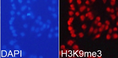 Anti-Histone H3K9me3 (tri-methyl Lys9) antibody used in Immunocytochemistry/ Immunofluorescence (ICC/IF). GTX54103