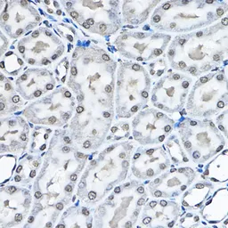 Anti-Histone H3K27me1 (mono-methyl Lys27) antibody used in IHC (Paraffin sections) (IHC-P). GTX54104