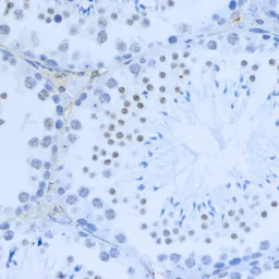 Anti-Histone H3K36me2 (di-methyl Lys36) antibody used in IHC (Paraffin sections) (IHC-P). GTX54108