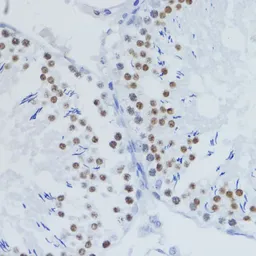 Anti-Histone H3K36me2 (di-methyl Lys36) antibody used in IHC (Paraffin sections) (IHC-P). GTX54108
