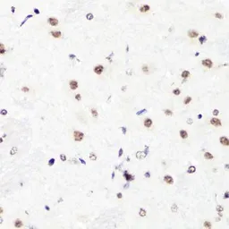 Anti-Histone H3R2me2 (Asymmetric Di-methyl Arg2) antibody used in IHC (Paraffin sections) (IHC-P). GTX54134