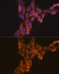 Anti-GDNF Receptor alpha 1 antibody used in Immunocytochemistry/ Immunofluorescence (ICC/IF). GTX54146
