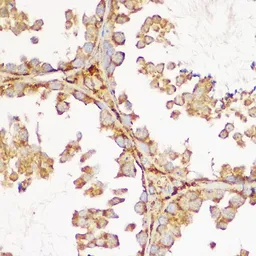 Anti-GDNF Receptor alpha 1 antibody used in IHC (Paraffin sections) (IHC-P). GTX54146