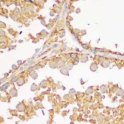 Anti-GDNF Receptor alpha 1 antibody used in IHC (Paraffin sections) (IHC-P). GTX54146