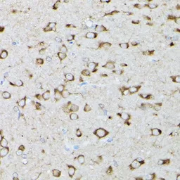 Anti-GARS antibody used in Immunocytochemistry/ Immunofluorescence (ICC/IF). GTX54147