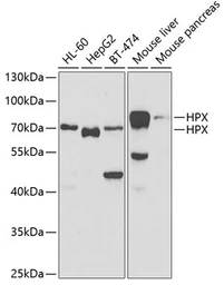 Anti-Hemopexin antibody used in Western Blot (WB). GTX54150