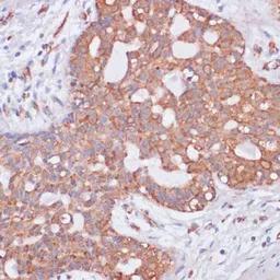 Anti-Kv11.1 antibody used in IHC (Paraffin sections) (IHC-P). GTX54285