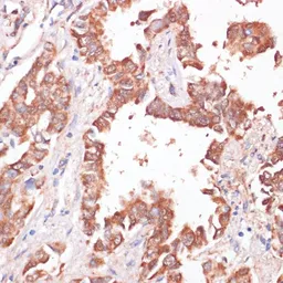 Anti-Kv11.1 antibody used in IHC (Paraffin sections) (IHC-P). GTX54285