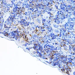 Anti-Lck antibody used in IHC (Paraffin sections) (IHC-P). GTX54287