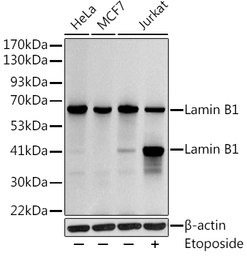 Anti-Lamin B1 antibody used in Western Blot (WB). GTX54288