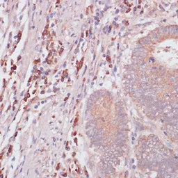 Anti-IFNAR2 antibody used in IHC (Paraffin sections) (IHC-P). GTX54289