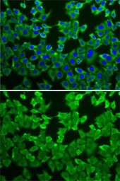 Anti-MTAP antibody used in Immunocytochemistry/ Immunofluorescence (ICC/IF). GTX54291