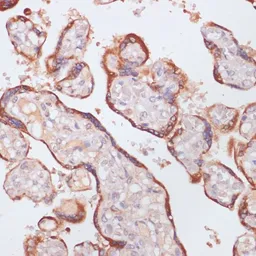 Anti-Plasma Kallikrein 1B antibody used in IHC (Paraffin sections) (IHC-P). GTX54292