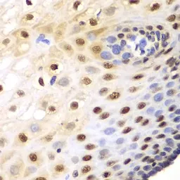 Anti-SRP1 antibody used in IHC (Paraffin sections) (IHC-P). GTX54302
