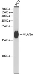 Anti-Melan A antibody used in Western Blot (WB). GTX54303