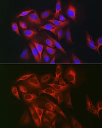 Anti-KEAP1 antibody used in Immunocytochemistry/ Immunofluorescence (ICC/IF). GTX54329