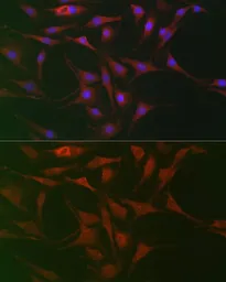 Anti-KEAP1 antibody used in Immunocytochemistry/ Immunofluorescence (ICC/IF). GTX54329