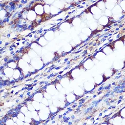 Anti-LETMD1 antibody used in IHC (Paraffin sections) (IHC-P). GTX54331