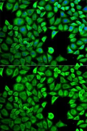 Anti-LTA4H antibody used in Immunocytochemistry/ Immunofluorescence (ICC/IF). GTX54332