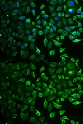 Anti-IMPA1 antibody used in Immunocytochemistry/ Immunofluorescence (ICC/IF). GTX54348