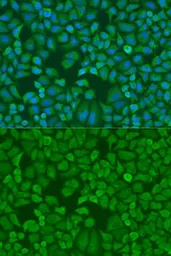 Anti-IGF2BP1 antibody used in Immunocytochemistry/ Immunofluorescence (ICC/IF). GTX54359