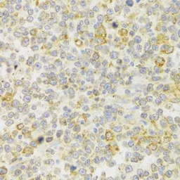 Anti-GPR54 antibody used in IHC (Paraffin sections) (IHC-P). GTX54378
