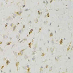Anti-GPR54 antibody used in IHC (Paraffin sections) (IHC-P). GTX54378