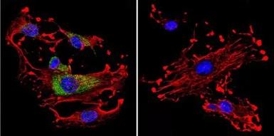 Anti-CDC42 antibody used in Immunocytochemistry/ Immunofluorescence (ICC/IF). GTX54514