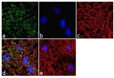 Anti-Vinculin (phospho Tyr100) antibody used in Immunocytochemistry/ Immunofluorescence (ICC/IF). GTX54517