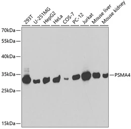 Anti-PSMA4 antibody used in Western Blot (WB). GTX54544