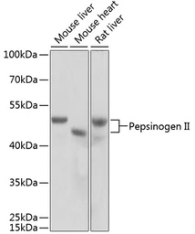 Anti-Pepsinogen II antibody used in Western Blot (WB). GTX54555
