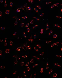 Anti-PAH antibody used in Immunocytochemistry/ Immunofluorescence (ICC/IF). GTX54563