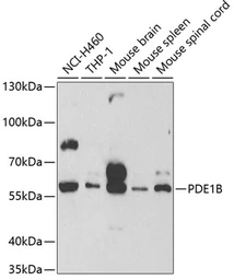 Anti-PDE1B antibody used in Western Blot (WB). GTX54568