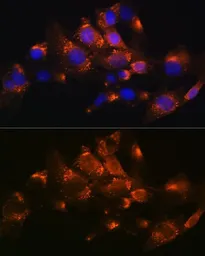 Anti-ADFP antibody used in Immunocytochemistry/ Immunofluorescence (ICC/IF). GTX54569