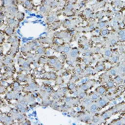 Anti-ADFP antibody used in IHC (Paraffin sections) (IHC-P). GTX54569