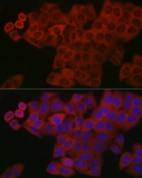 Anti-PDGF beta antibody used in Immunocytochemistry/ Immunofluorescence (ICC/IF). GTX54575