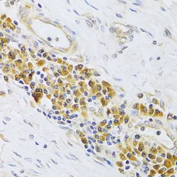 Anti-EBP1 antibody used in IHC (Paraffin sections) (IHC-P). GTX54589