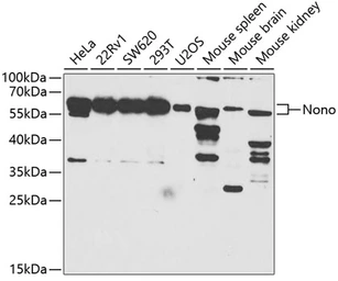 Anti-p54nrb antibody used in Western Blot (WB). GTX54596