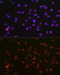 Anti-p54nrb antibody used in Immunocytochemistry/ Immunofluorescence (ICC/IF). GTX54596