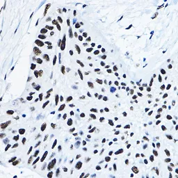 Anti-p54nrb antibody used in IHC (Paraffin sections) (IHC-P). GTX54596