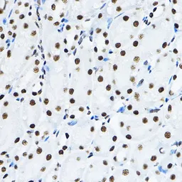 Anti-p54nrb antibody used in IHC (Paraffin sections) (IHC-P). GTX54596