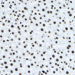 Anti-p54nrb antibody used in IHC (Paraffin sections) (IHC-P). GTX54596
