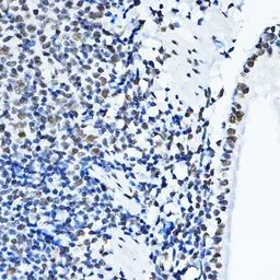 Anti-p54nrb antibody used in IHC (Paraffin sections) (IHC-P). GTX54596