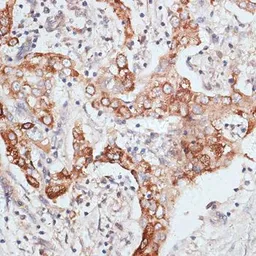 Anti-PIGR antibody used in IHC (Paraffin sections) (IHC-P). GTX54608