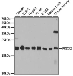 Anti-PRX II antibody used in Western Blot (WB). GTX54610
