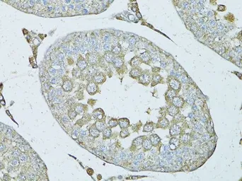 Anti-PSMF1 antibody used in IHC (Paraffin sections) (IHC-P). GTX54613